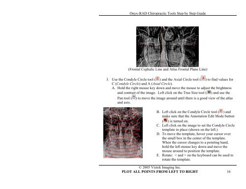 Onyx-RAD Chiropractic Tools Step by Step Guide - Viztek