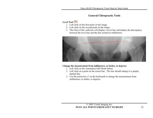 Onyx-RAD Chiropractic Tools Step by Step Guide - Viztek