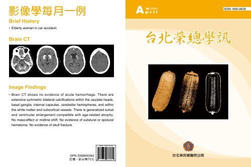 Brief History Image Findings Brain CT - å°åæ¦®ç¸½æå­¸ç ç©¶é¨- å°åæ¦® ...