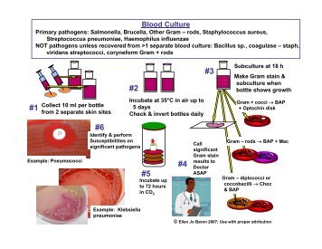 Blood culture - GLOBE Network