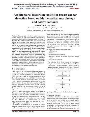 Architectural distortion model for breast cancer detection based on ...