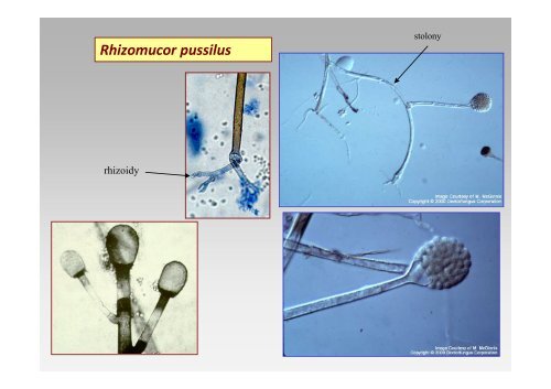 Glomeromycota, Zygomycotina a Chytridiomycota - Mykologie