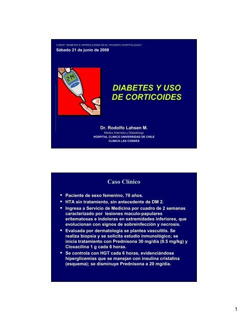 Diabetes y uso de Corticoides