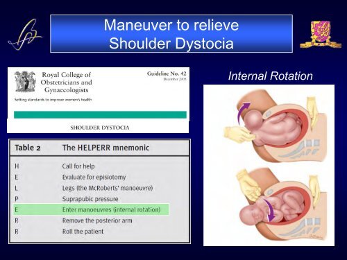 Shoulder dystocia orth