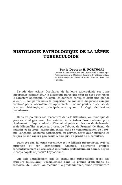 HISTOLOGIE PATHOLOGIQUE DE LA LÃPRE TUBERCULOIDE