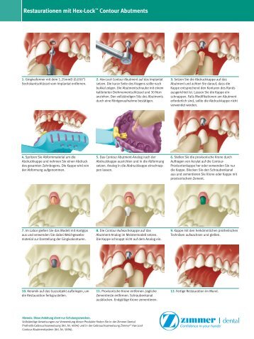 Hex-Lock Contour Abutment - Zimmer Dental