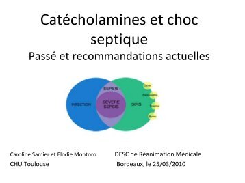 Utilisation des catécholamines dans le choc septique