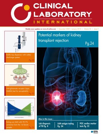 Potential markers of kidney transplant rejection