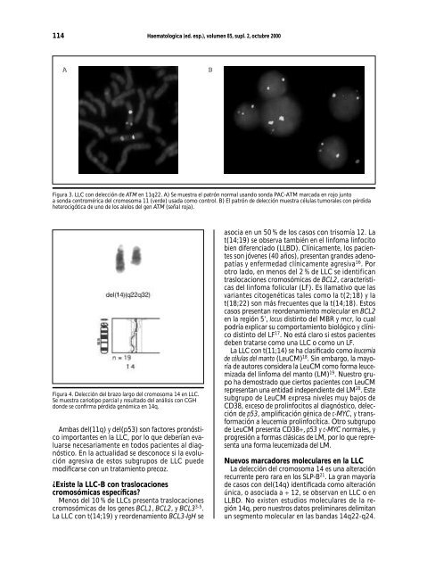 Portada Simposios - Supplements - Haematologica