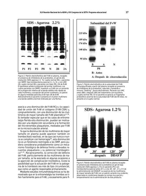 Portada Simposios - Supplements - Haematologica