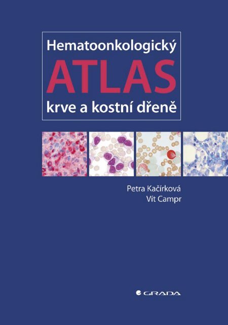 HematoonkologickÃ½ atlas krve a kostnÃ­ dÅenÄ