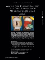 adapting fiber-reinforced composite root canal posts for use in ...