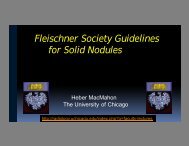 Fleischner Society Guidelines for Solid Nodules - University of ...