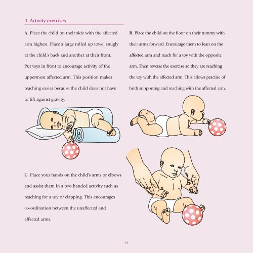 Understanding Brachial Plexus Palsy - The Royal Children's Hospital