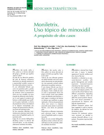 Moniletrix. Uso tÃ³pico de minoxidil