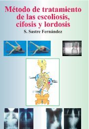 MÃ©todo de tratamiento de las escoliosis, cifosis y lordosis