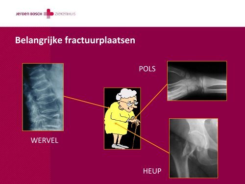 Osteoporose - Jeroen Bosch Ziekenhuis