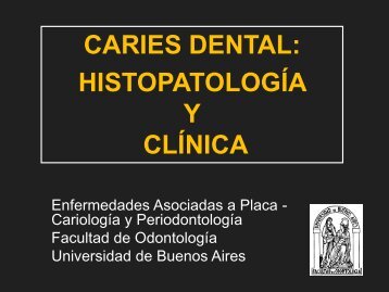 CARIES DENTAL ASPECTO MICROSCOPICO - Facultad de ...