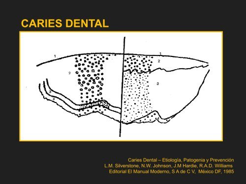 CARIES DENTAL ASPECTO MICROSCOPICO - Facultad de ...