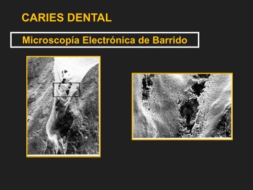 CARIES DENTAL ASPECTO MICROSCOPICO - Facultad de ...