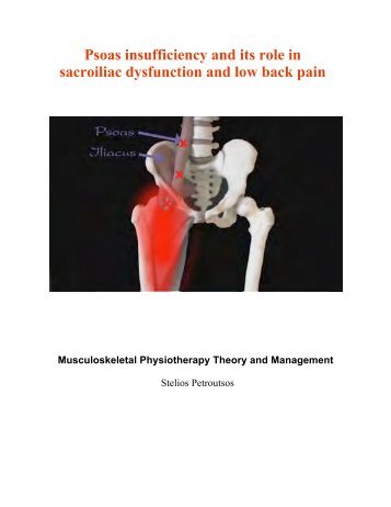 Psoas insufficiency and its  role in sacroiliac ... - Physio Kinetics