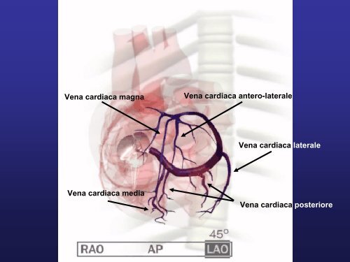 L aiuto elettrico allo scompenso refrattario - Cuorediverona.it