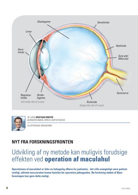 operation maculahul - Øjenforeningen Værn om Synet