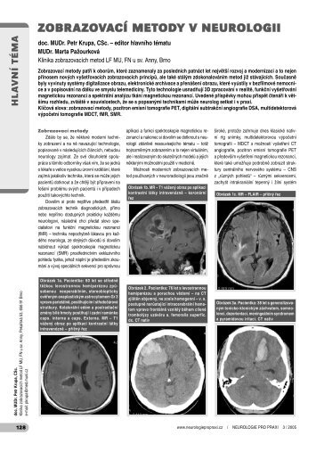 OtevÅ™Ã­t - Neurologie pro praxi