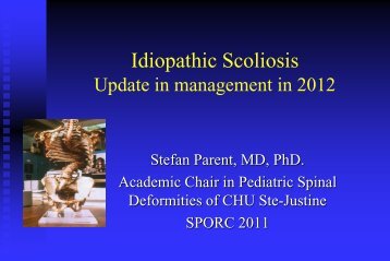 Idiopathic Scoliosis - CHU Sainte-Justine - SAAC