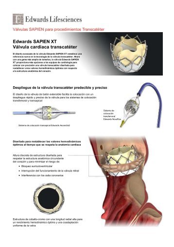 Caracteristicas