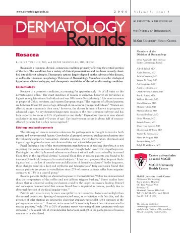 Rosacea - Dermatologyrounds.ca