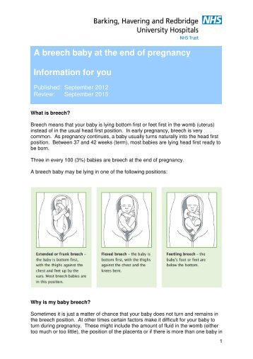 A breech baby at the end of pregnancy Information for you
