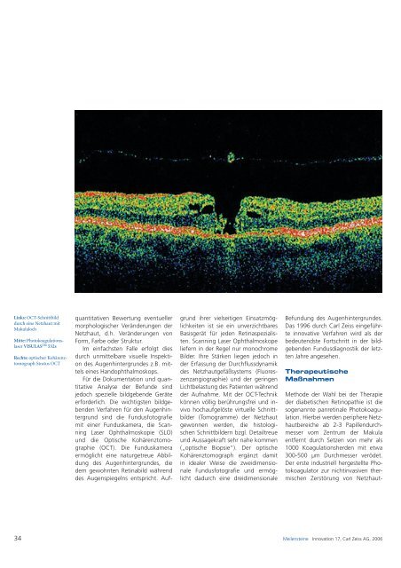 Der empfindliche Sensor - Carl Zeiss