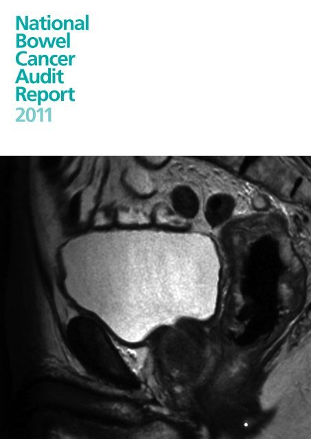 National Bowel Cancer Audit Report 2011 - HQIP