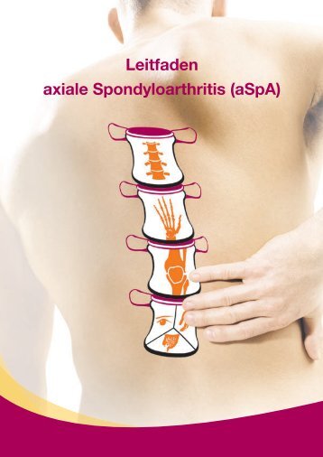 Leitfaden axiale Spondyloarthritis (aSpA)