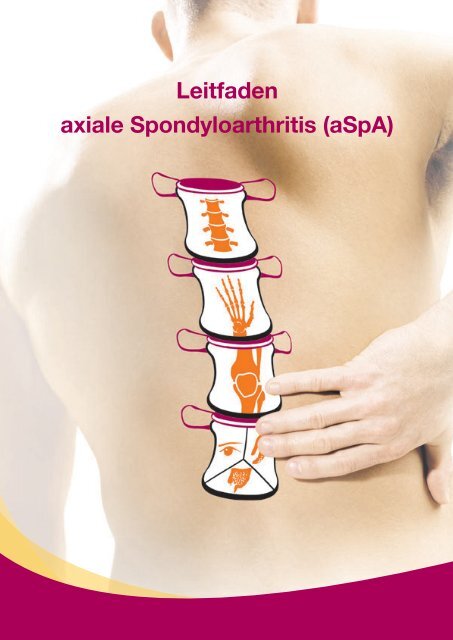 Leitfaden axiale Spondyloarthritis (aSpA)