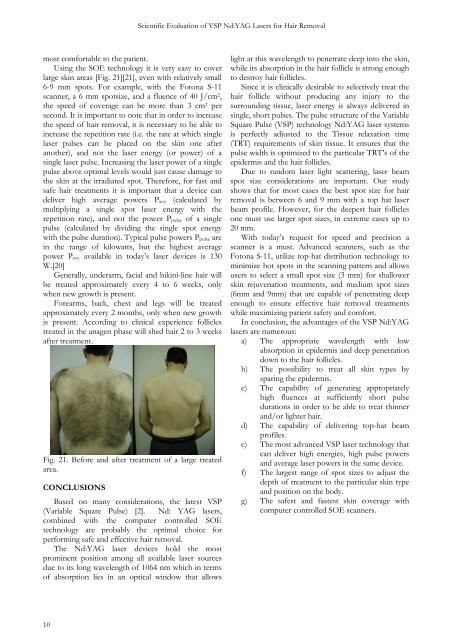 Scientific Evaluation of VSP Nd:YAG Lasers for Hair Removal - Fotona