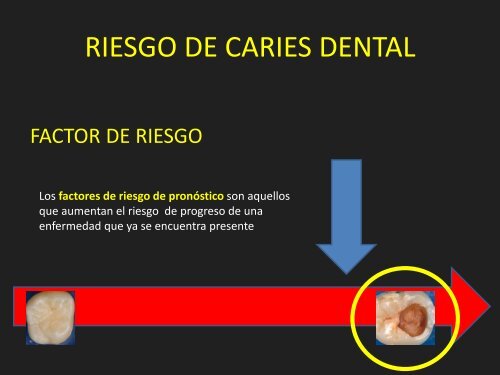 PERFILES DE RIESGO DE CARIES DENTAL