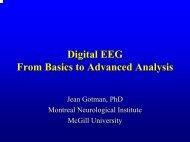 Digital EEG From Basics to Advanced Analysis
