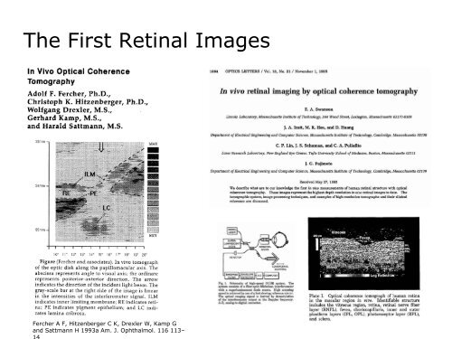 08a Optical Coherence Tomography (OCT) - 1. History 2011