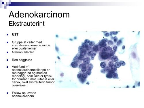 Endometriekancer og extrauterine metastaser - Dansk ...