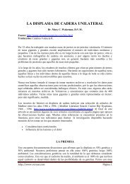 [pdf] **la displasia de cadera unilateral - Voraus