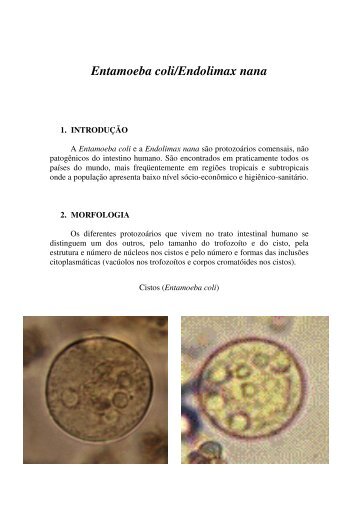 Entamoeba coli/Endolimax nana - Ucg