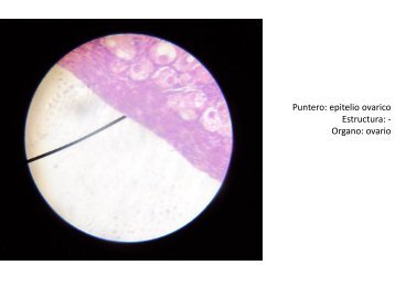 Puntero: epitelio ovarico Estructura: - Organo: ovario