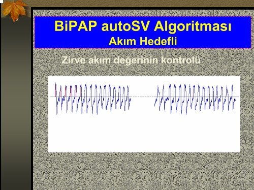 BIPAP Cihaz Ãzellikleri ve EndikasyonlarÄ±