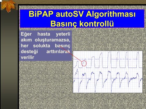 BIPAP Cihaz Ãzellikleri ve EndikasyonlarÄ±