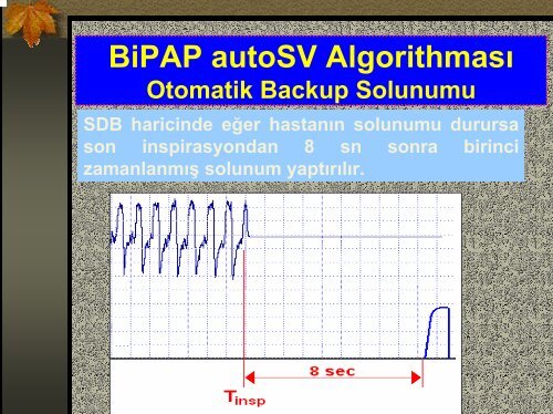 BIPAP Cihaz Ãzellikleri ve EndikasyonlarÄ±