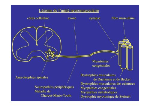 Dystrophies musculaires Myopathie congÃ©nitales Myopathies ...