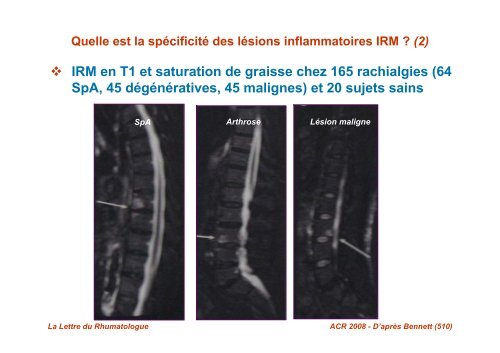 le bassin de face, le rachis lombaire face et profil