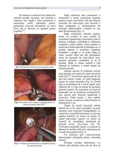 PDF (5 MB) - Jurnalul de Chirurgie